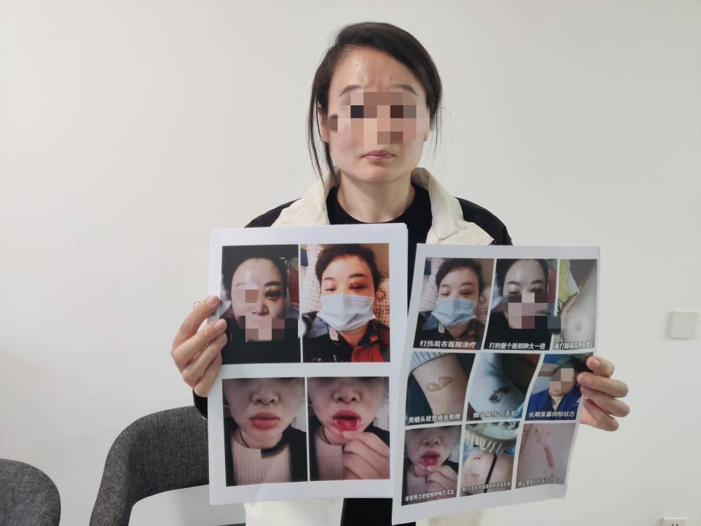 足球波胆_郑州一女子被企业家丈夫家暴最新进展：已要回孩子抚养权