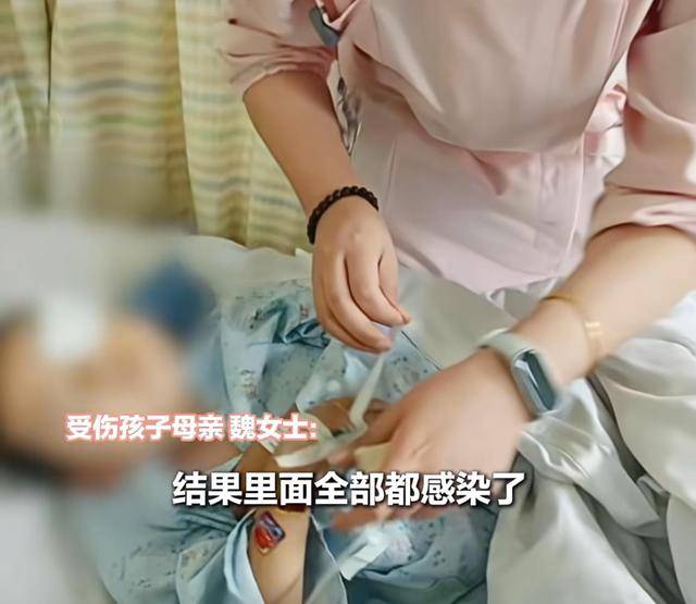 马耳他 vs 荷兰_江西一5岁男孩在幼儿园被戳伤致左眼失明马耳他 vs 荷兰，家长称老师用猪油涂抹试图消肿