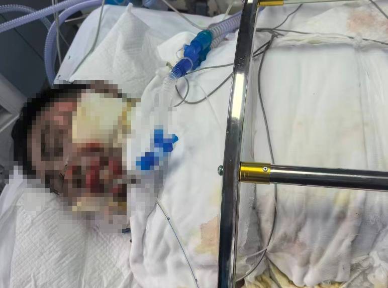 皇冠官网_滚烫的水皇冠官网，从头流到脚！今晚洗澡前紧急提醒！