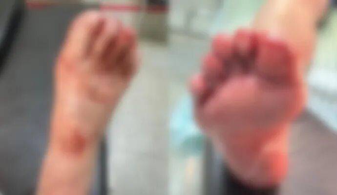 新2备用网址_洗澡时一声巨响新2备用网址,浙江小女孩腿上、脚上全是血!小心你家中藏的“不定时炸弹”……