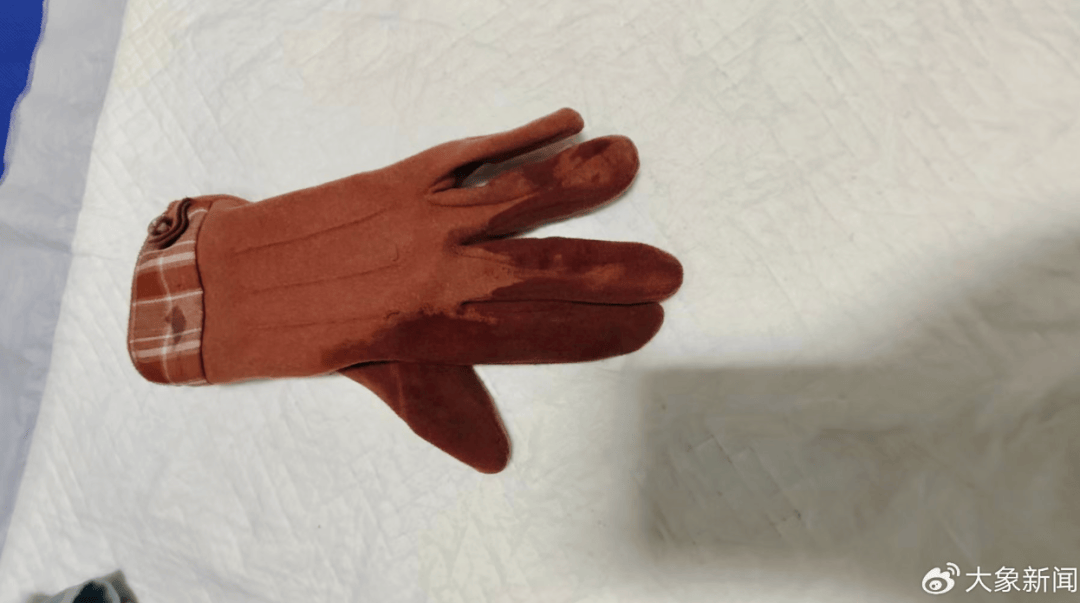 正版皇冠信用网代理_河南一男子街头挥刀乱刺正版皇冠信用网代理，被休假女警一脚踢落凶器！女警面部缝合30余针，手套被血浸透