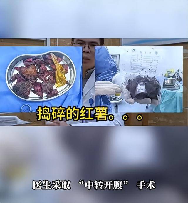 皇冠返水
_61岁男子将17cm红薯塞入肛门皇冠返水
,半夜疼痛难忍被迫就医,医生:尺寸过大,得开腹